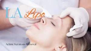 Woman receiving Actinic Keratosis Removal Treatment Lancashire