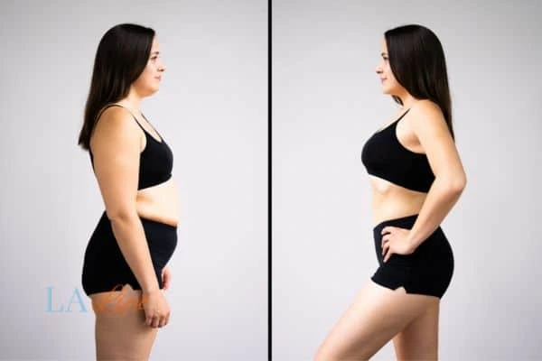 LA-EMS Body Sculpting Lancashire results before and after of womans results on body toning.