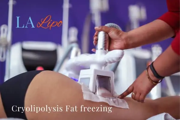 women getting fat freezing Lancashire