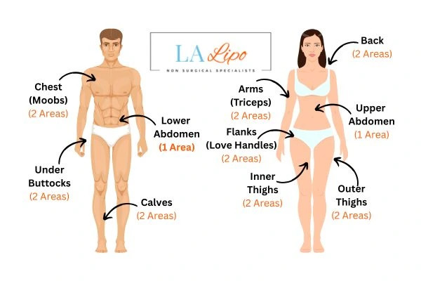 LA LIPO Cryolipolysis Areas Lancashire