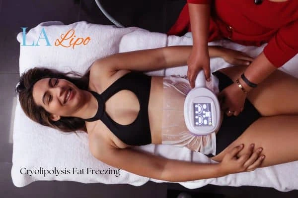 woman getting cryolipolysis Lancashire