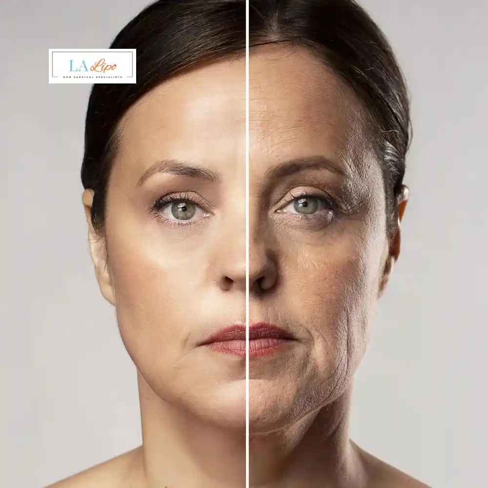 How Can You Tell If Non-Surgical Skin Tightening Is Right for You Lancashire?