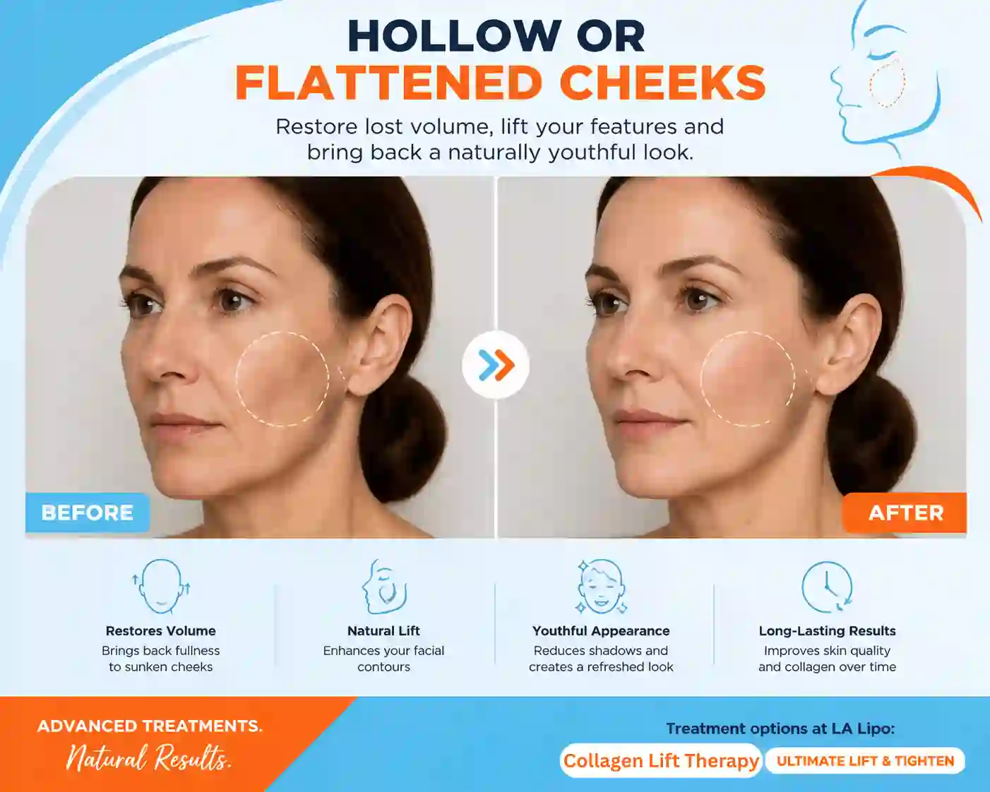 Sign #4: Hollow or Flattened Cheeks Lancashire