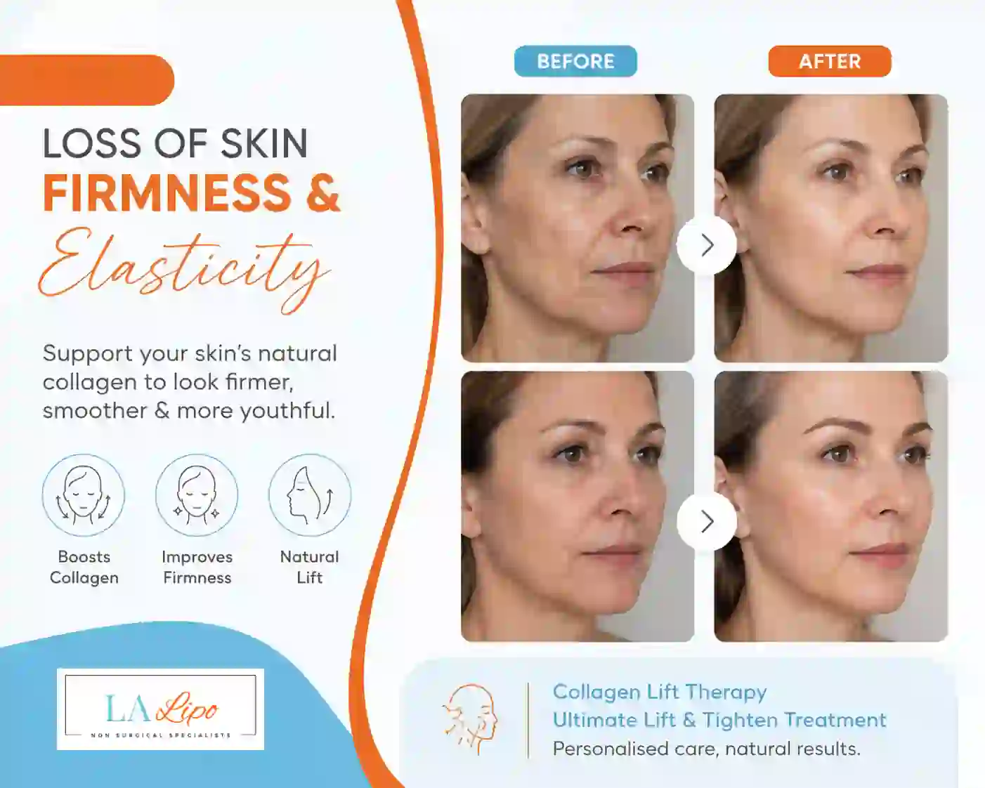 Sign #7: Loss of Skin Firmness and Elasticity Lancashire